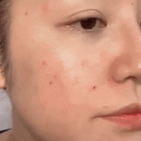 Perfeccionador facial de alta cobertura – Borra imperfecciones y se adapta a tu tono de piel ✨ HOY 30% DCTO