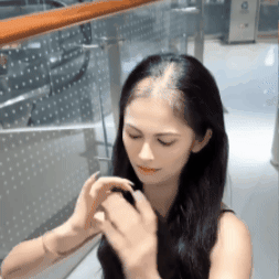 Prótesis de cabello base con flequillo para ocultar la calvicie - Lo puedes tinturar, rizar o alisar✨HOY 50% DCTO